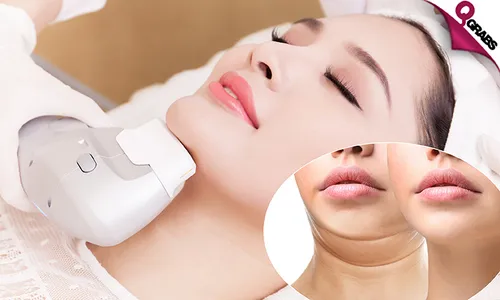 Skin Tightening HIFU Sessions for Face, Neck & More for Ladies & Men!